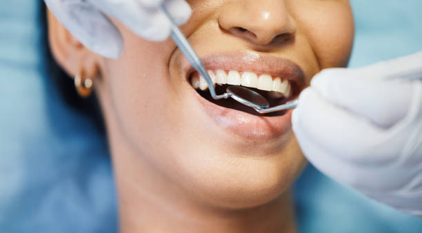 Best Emergency Wisdom Teeth Removal in Dayton, OH